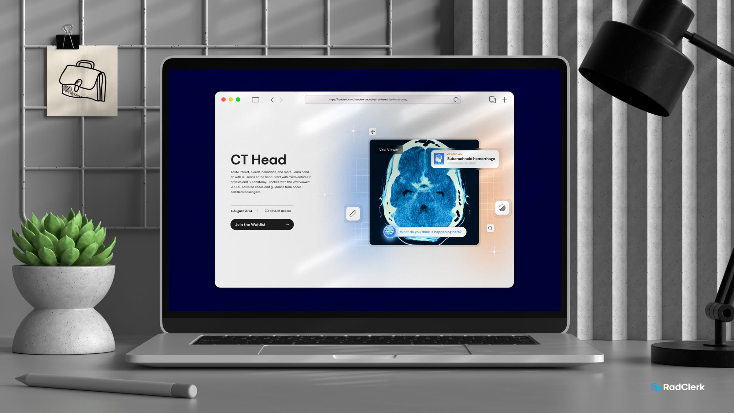 RadClerk launches CT Head for Institutional Subscribers